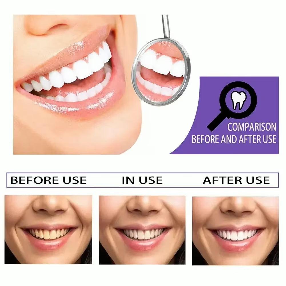 Teeth Whitening Toothpaste Mousse Remove Plaque Stains - Multi Mart