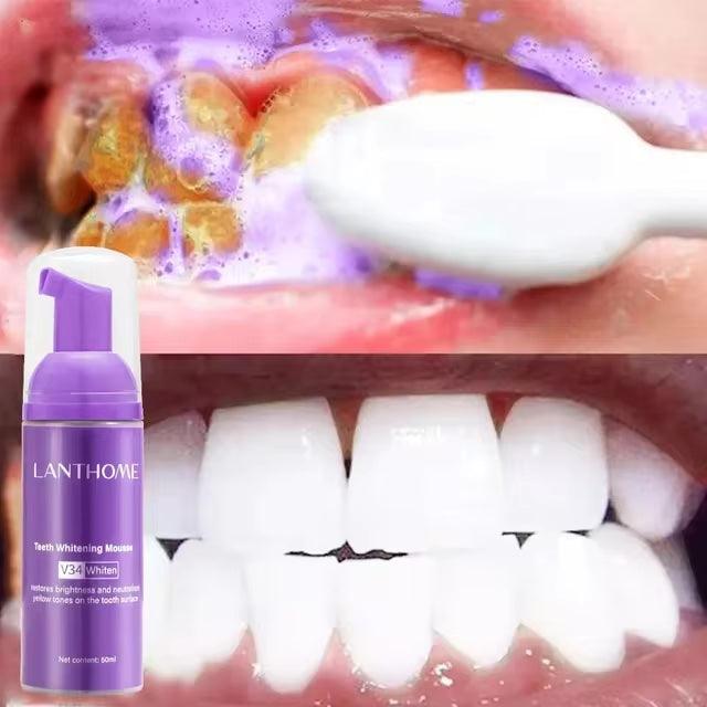 Teeth Whitening Toothpaste Mousse Remove Plaque Stains - Multi Mart